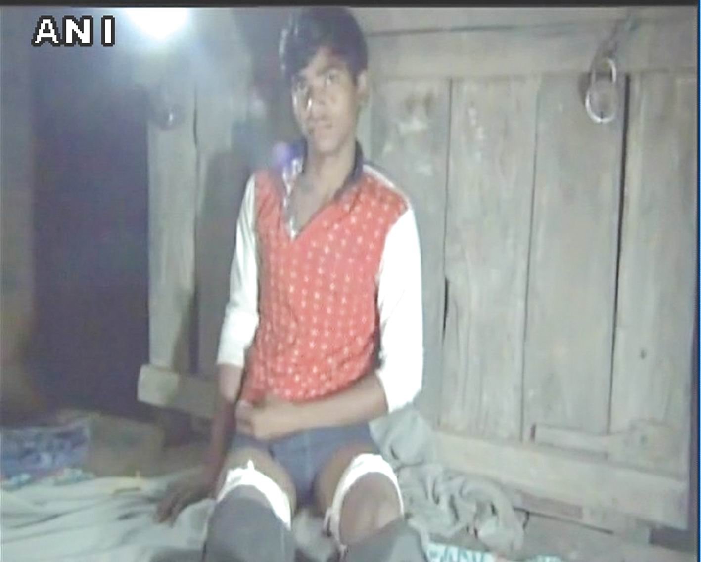 કાનપુર : ડ્રેસ પહેર્યા વગર શાળામાં જનાર  વિદ્યાર્થીના શાળા સંચાલકોએ પગ કાપી નાંખ્યા